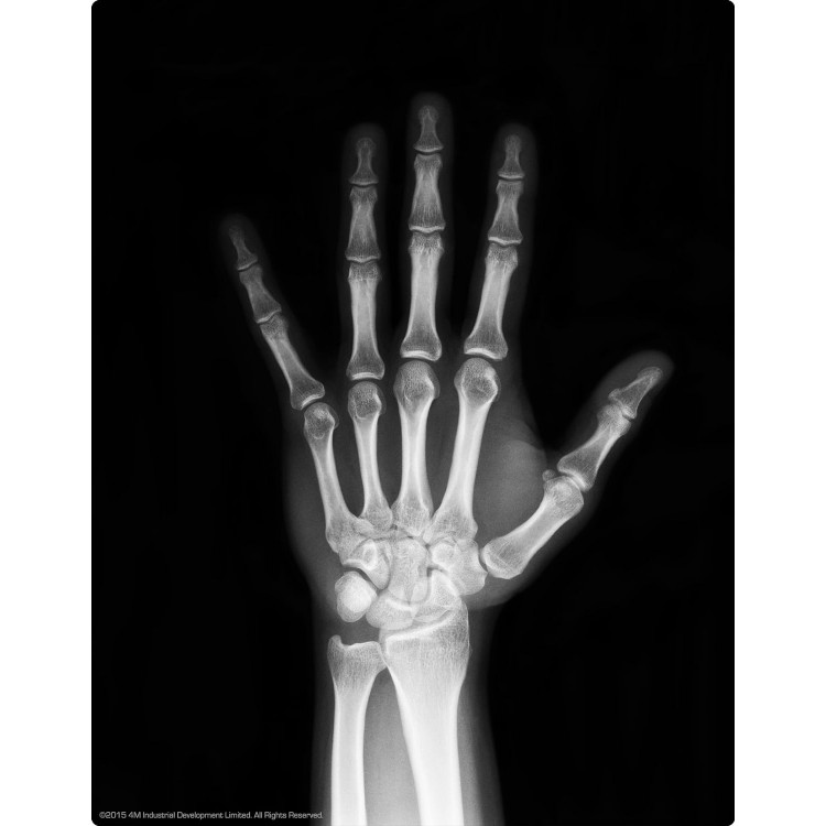 Parlayan Insan Iskeleti Magnet Seti İskelet Sistemini Öğretici Set